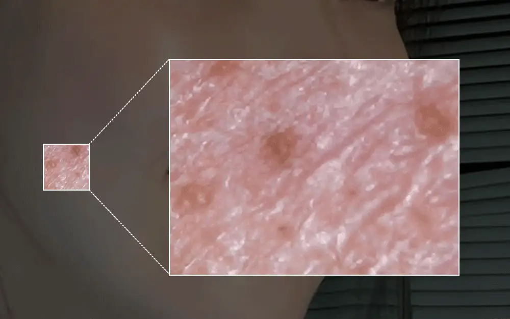 [모공딥클렌징] 성분에디터 그린토마토 딥 포어 클렌징 울트라 휘핑 폼 120g 상세페이지 8